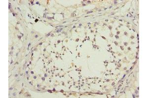 Immunohistochemistry of paraffin-embedded human testis tissue using ABIN7150890 at dilution of 1:100 (DNAL4 antibody  (AA 1-105))