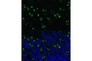 Immunofluorescence analysis of rat colon using CLC Polyclonal Antibody (5041) at dilution of 1:100 (40x lens). (CLCA1 antibody  (AA 22-150))