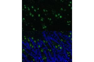 Immunofluorescence analysis of rat colon using CLC Polyclonal Antibody (5041) at dilution of 1:100 (40x lens).