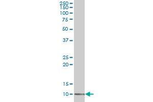 LSM2 polyclonal antibody (A01), Lot # 061130JCS1 Western Blot analysis of LSM2 expression in 293 . (LSM2 antibody  (AA 1-95))