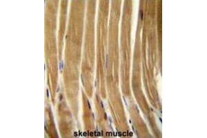 Immunohistochemistry (IHC) image for anti-Caspase 5, Apoptosis-Related Cysteine Peptidase (CASP5) antibody (ABIN2995932) (CASP5 antibody)