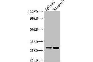 Western Blot Positive WB detected in: Mouse spleen tissue, Mouse stomach tissue All lanes: CTRB1 antibody at 3 μg/mL Secondary Goat polyclonal to rabbit IgG at 1/50000 dilution Predicted band size: 28 kDa Observed band size: 28 kDa (CTRB1 antibody  (AA 19-263))