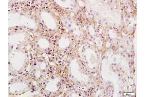 Formalin-fixed and paraffin embedded human kidney labeled with Rabbit Anti-PDGFBB Polyclonal Antibody, Unconjugated  at 1:200 followed by conjugation to the secondary antibody and DAB staining, (PDGF-BB Homodimer (AA 151-241) antibody)
