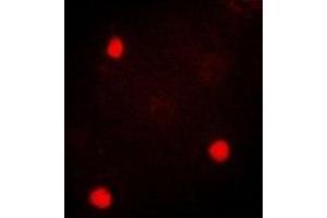Immunofluorescent analysis of TIA1 staining in SKOV3 cells. (TIA1 antibody)
