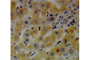 Used in DAB staining on fromalin fixed paraffin-embedded Liver tissue (DGKE antibody  (AA 243-502))