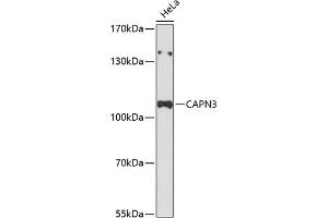 Western blot analysis of extracts of HeLa cells, using C Antibody (ABIN6127547, ABIN6137919, ABIN6137921 and ABIN6215925) at 1:3000 dilution. (Calpain 3 antibody  (AA 1-150))