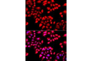 Immunofluorescence analysis of A549 cells using XRCC6 antibody. (XRCC6 antibody)
