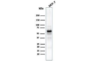 Western Blot Analysis of MCF-7 cell lysate using AKT1 Recombinant Mouse Monoclonal Antibody (rAKT1/2491). (Recombinant AKT1 antibody  (AA 85-189))