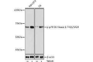 Western blot analysis of extracts of various cell lines, using Phospho-p70 S6 Kinase 1-T421/S424 Rabbit mAb (ABIN6135340, ABIN6136296, ABIN6136297 and ABIN7101878) at 1:1000 dilution. (RPS6KB1 antibody  (pSer424, pThr421))