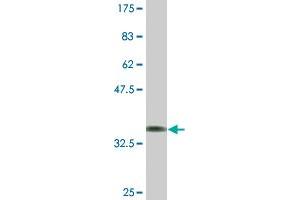 Western Blot detection against Immunogen (37. (Dopamine d2 Receptor antibody  (AA 1-110))