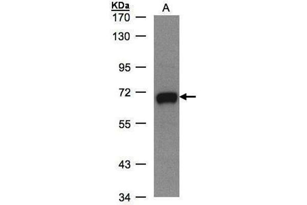 GALNT2 antibody