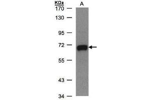 WB Image Sample(30 ug whole cell lysate) A:MOLT4 , 7. (GALNT2 antibody)