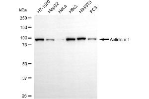 Western blotting analysis using actinin alpha 1 antibody (ABIN7797471).