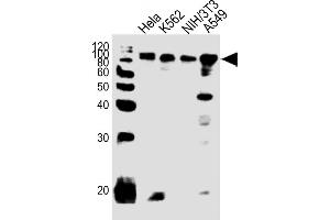 All lanes : Anti-EWSR1 Antibody (C-term) at 1:1000 dilution Lane 1: Hela whole cell lysates Lane 2: K562 whole cell lysates Lane 3: NIH/3T3 whole cell lysates Lane 4: A549 whole cell lysates Lysates/proteins at 20 μg per lane. (EWSR1 antibody  (C-Term))