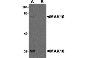 Western Blotting (WB) image for anti-MAK10 Homolog, Amino-Acid N-Acetyltransferase Subunit (MAK10) (N-Term) antibody (ABIN1031448) (MAK10/NAA35 antibody  (N-Term))