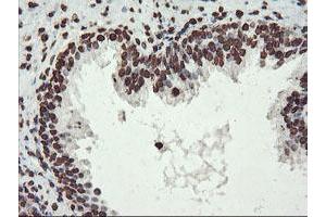 Image no. 11 for anti-F-Box Protein 21 (FBXO21) antibody (ABIN1498233) (FBXO21 antibody)