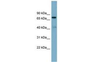 Image no. 1 for anti-P53-Induced Death Domain Protein (PIDD) (AA 143-192) antibody (ABIN6744153) (PIDD antibody  (AA 143-192))