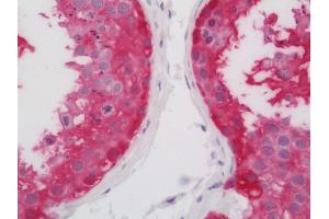 Human Testis: Formalin-Fixed, Paraffin-Embedded (FFPE). (ASB9 antibody  (Biotin))