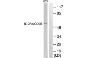 Western blot analysis of extracts from LOVO cells, using IL-2R alpha/CD25 (Ab-268) Antibody.