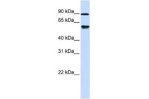 ADHFE1 antibody used at 1 ug/ml to detect target protein. (ADHFE1 antibody  (Middle Region))
