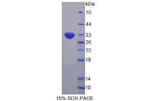 Image no. 1 for 2'-5'-Oligoadenylate Synthetase-Like (OASL) (AA 2-244) protein (His tag) (ABIN4990458)
