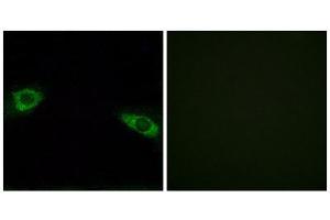 Immunofluorescence (IF) image for anti-Ribosomal Protein S4, Y-Linked 1 (RPS4Y1) (C-Term) antibody (ABIN1850592)