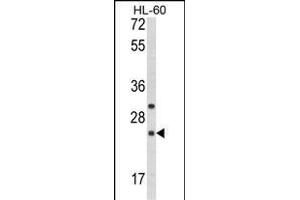 Western blot analysis of RGS1 Antibody (N-term) (ABIN652704 and ABIN2842468) in HL-60 cell line lysates (35 μg/lane). (RGS1 antibody  (N-Term))