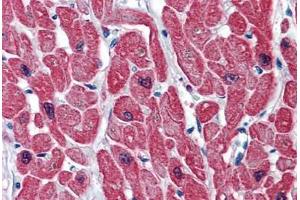 Human Heart: Formalin-Fixed, Paraffin-Embedded (FFPE) (TNNI3 antibody  (AA 102-211))