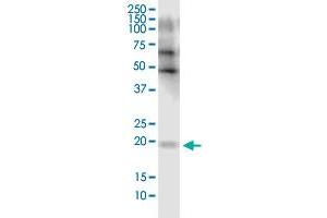 FLJ35767 monoclonal antibody (M03), clone 2F3. (FLJ35767 (AA 1-164) antibody)