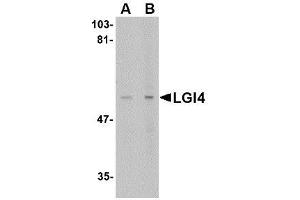Image no. 1 for anti-Leucine-Rich Repeat LGI Family, Member 4 (LGI4) (C-Term) antibody (ABIN1492213) (LGI4 antibody  (C-Term))