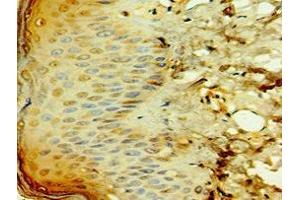 Immunohistochemistry of paraffin-embedded human skin tissue using ABIN7171674 at dilution of 1:100 (TCTN2 antibody  (AA 420-670))