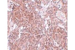 Immunohistochemistry (IHC) image for anti-Tetraspanin 9 (TSPAN9) (Middle Region) antibody (ABIN1031151) (Tetraspanin 9 antibody  (Middle Region))