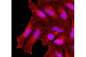 Immunofluorescence of human HeLa cells stained with monoclonal anti-human KCDT15 antibody (1:500) with Texas Red (Red). (KCTD15 antibody  (AA 1-234))