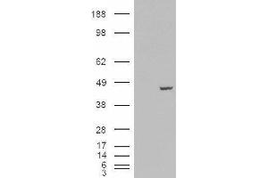 Western Blotting (WB) image for Poly(rC) Binding Protein 4 (PCBP4) peptide (ABIN369463) (Poly(rC) Binding Protein 4 (PCBP4) Peptide)