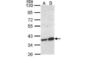 WB Image Sample (30 ug of whole cell lysate) A: Molt-4 , B: Raji 10% SDS PAGE antibody diluted at 1:1000 (ACMSD antibody)