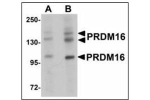 Western blot analysis of PRDM16 in rat brain tissue lysate with after heat-induced antigen retrieval at (A) 1 and (B) 2 µg/ml.