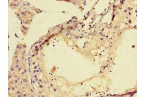 Immunohistochemistry of paraffin-embedded human testis tissue using ABIN7173726 at dilution of 1:100 (TPPP3 antibody  (AA 2-176))