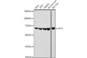 Western blot analysis of extracts of various cell lines, using CPT2 antibody (ABIN6129249, ABIN6138983, ABIN6138984 and ABIN6216045) at 1:1000 dilution. (CPT2 antibody  (AA 1-180))