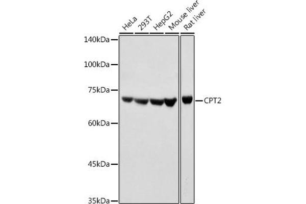 CPT2 Antikörper  (AA 1-180)