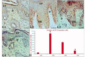 The effects of ustekinumab and CUC on PCNA IE in IQ-induced psoriatic skin lesions. (PCNA antibody)