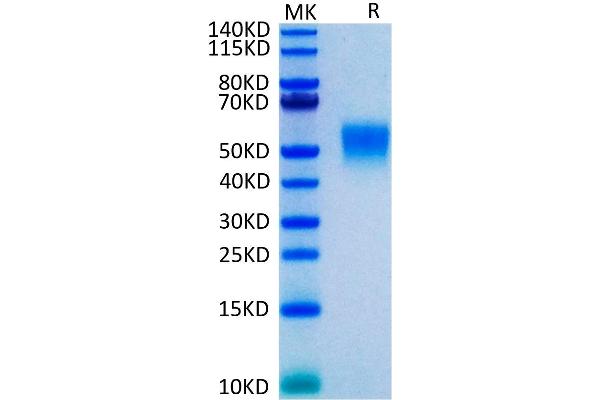 TNFRSF1B Protein (AA 23-257) (His tag)