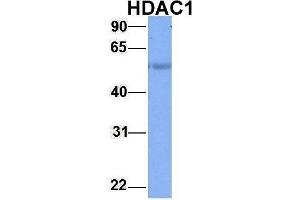Western Blotting (WB) image for anti-Histone Deacetylase 1 (HDAC1) (Middle Region) antibody (ABIN2779587)