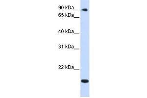 Western Blotting (WB) image for anti-TSR1, 20S rRNA Accumulation, Homolog (TSR1) antibody (ABIN2459005) (TSR1 antibody)