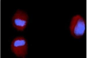 Immunofluorescence (IF) image for anti-Fibroblast Growth Factor 2 (Basic) (FGF2) (AA 143-288) antibody (PE) (ABIN5565476) (FGF2 antibody  (AA 143-288) (PE))