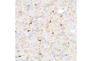 Immunohistochemistry of paraffin-embedded Mouse brain using /IB antibody (ABIN7265554) at dilution of 1:100 (40x lens). (Iba1 antibody)