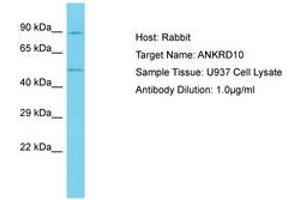Image no. 1 for anti-Ankyrin Repeat Domain 10 (ANKRD10) (AA 322-371) antibody (ABIN6750635) (ANKRD10 antibody  (AA 322-371))