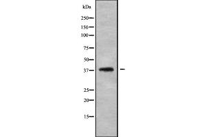 Western blot analysis of LT4R1 using HepG2 whole cell lysates (Leukotriene B4 Receptor/BLT antibody)