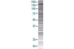 MAP3K5 transfected lysate. (MAP3K5 293T Cell Transient Overexpression Lysate(Denatured))