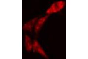 ABIN6274326 staining Hela cells by IF/ICC. (AKAP13 antibody  (Internal Region))