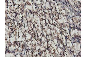 Image no. 3 for anti-V-Akt Murine Thymoma Viral Oncogene Homolog 1 (AKT1) antibody (ABIN1496556) (AKT1 antibody)